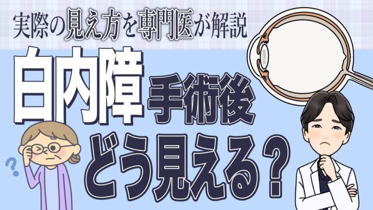 白内障手術後の見え方｜単焦点レンズで「遠く」「近く」「中間」どれを選ぶ？