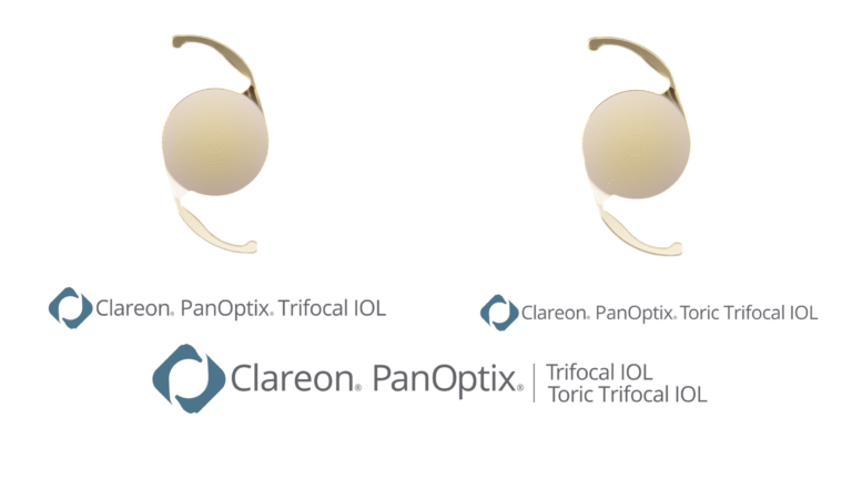 Clareon PanOptix 眼内レンズ