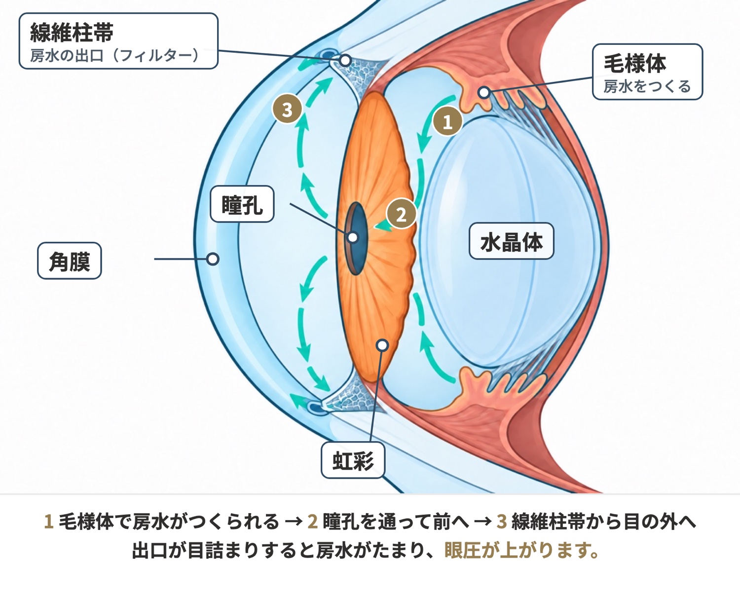 房水の流れの図。毛様体でつくられた房水が瞳孔を通って前へ流れ、線維柱帯から目の外へ出ていきます。出口が目詰まりすると眼圧が上がります