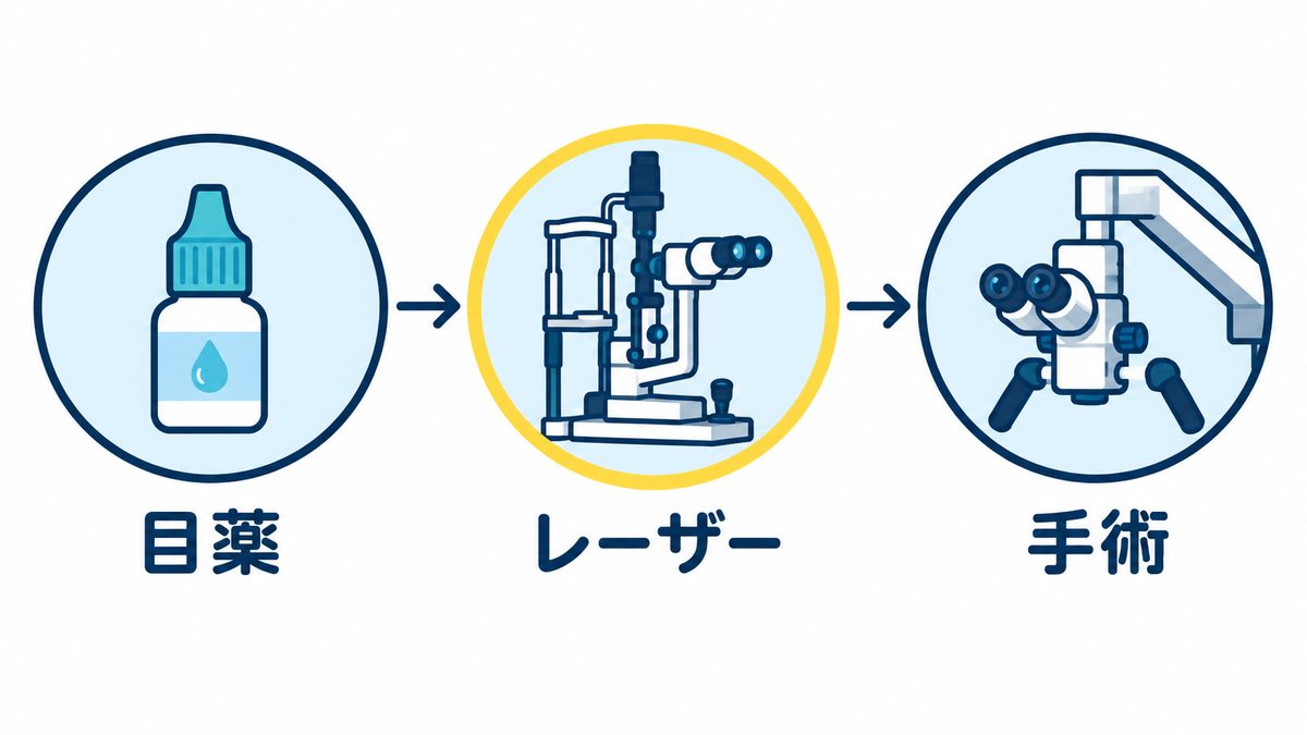 緑内障で眼圧を下げる3つの方法として、目薬、レーザー、手術を左から順に並べた図