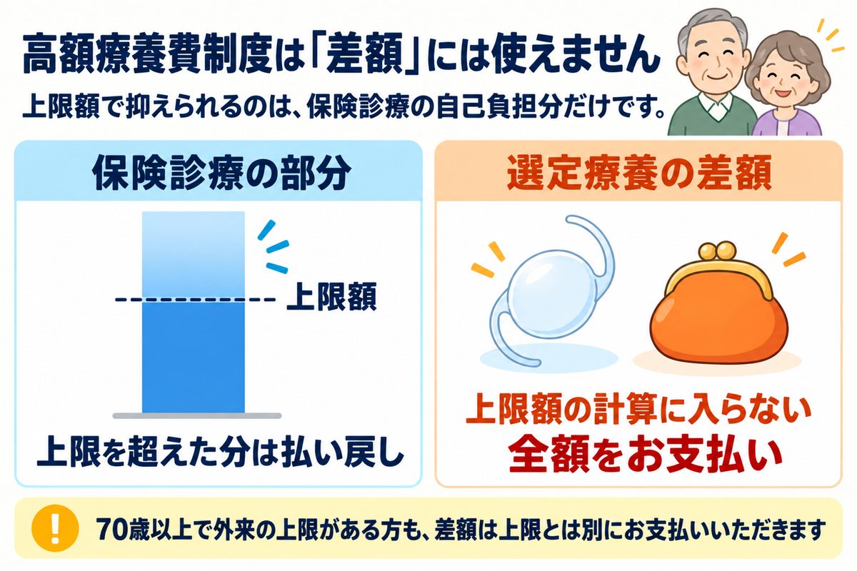 高額療養費制度の上限額で抑えられるのは保険診療の自己負担分だけで、選定療養の差額は上限額の計算に入らず全額支払うことを示した図解